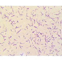 转让L-羟脯氨酸发酵工艺和菌种